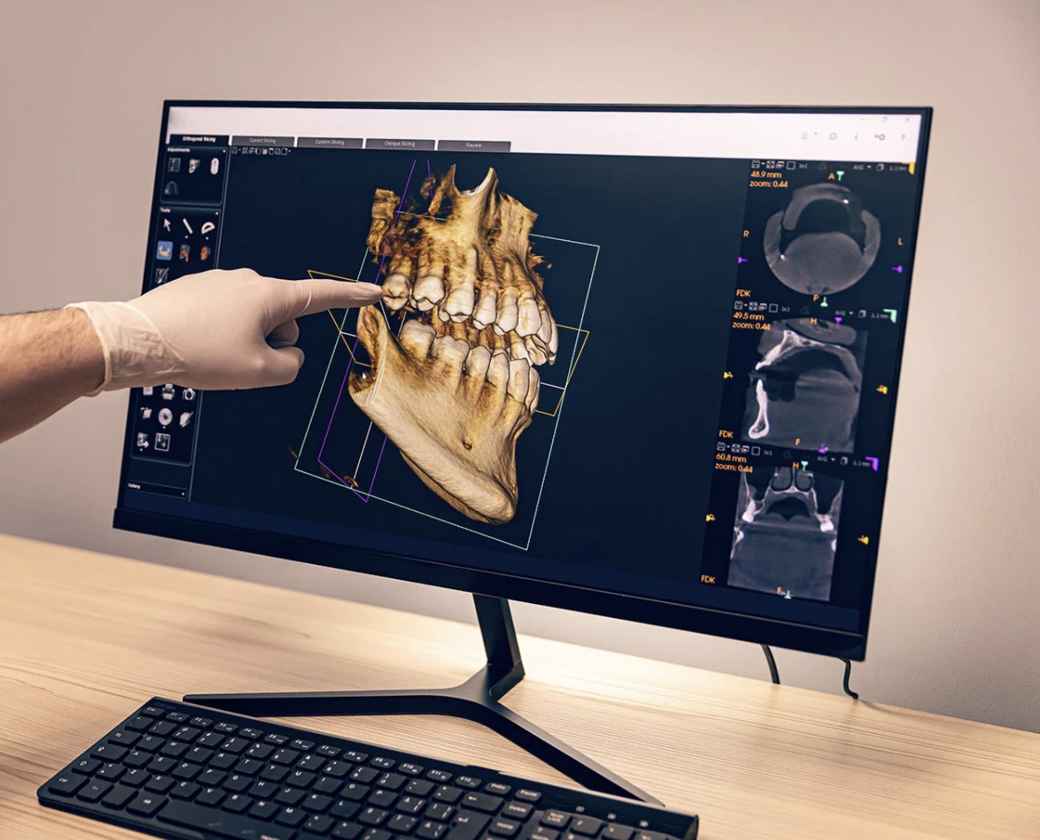 Diagnóstico Digital en 3D: Precisión Revolucionaria en Odontología